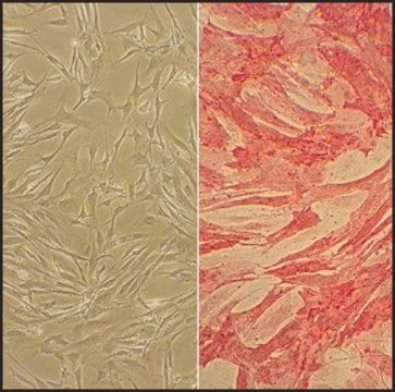 Human Pulmonary Artery Smooth Muscle Cells: HPASMC, adult