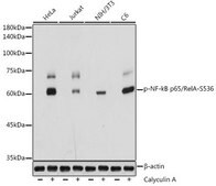 Anti-Phospho-NF-kB p65/RelA-S536 antibody produced in rabbit