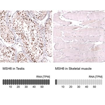 Monoclonal Anti-Msh6 Antibody Produced In Mouse Prestige Antibodies&#174; Powered by Atlas Antibodies, clone CL13844, affinity isolated antibody, buffered aqueous glycerol solution