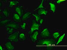 Monoclonal Anti-LDHB antibody produced in mouse clone 2H6, purified immunoglobulin, buffered aqueous solution