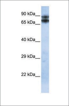 Anti-LIMA1 antibody produced in rabbit affinity isolated antibody