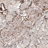Anti-CD44 antibody produced in mouse Prestige Antibodies&#174; Powered by Atlas Antibodies, clone CL13318, purified by using Protein A, buffered aqueous glycerol solution