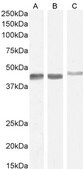 Anti-Smooth Muscle &#945;-Actin antibody produced in goat affinity isolated antibody, buffered aqueous solution