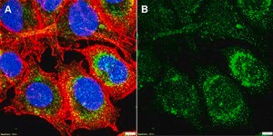 Anti-Dopamine D1 receptor Antibody, clone 2L4 ZooMAb&#174; Rabbit Monoclonal recombinant, expressed in HEK 293 cells