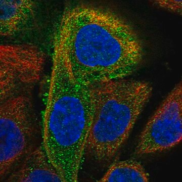 Anti-DDX58 antibody produced in rabbit affinity isolated antibody