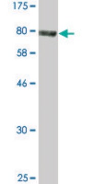 Monoclonal Anti-ACD antibody produced in mouse clone 1C11-1A7, purified immunoglobulin, buffered aqueous solution