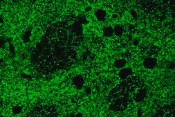 Anti-Glutamate Transporter Antibody, Glial serum, Chemicon&#174;