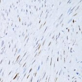 Anti-P21 antibody produced in rabbit