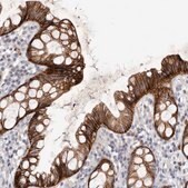 Anti-FAS antibody produced in rabbit Prestige Antibodies&#174; Powered by Atlas Antibodies, affinity isolated antibody, buffered aqueous glycerol solution