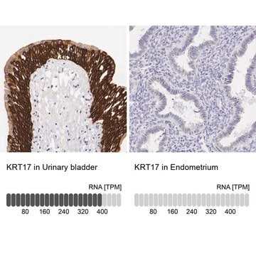 Anti-KRT17 antibody produced in rabbit Ab2, Prestige Antibodies&#174; Powered by Atlas Antibodies, affinity isolated antibody, buffered aqueous glycerol solution