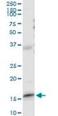 Anti-FABP5 antibody produced in rabbit purified immunoglobulin, buffered aqueous solution