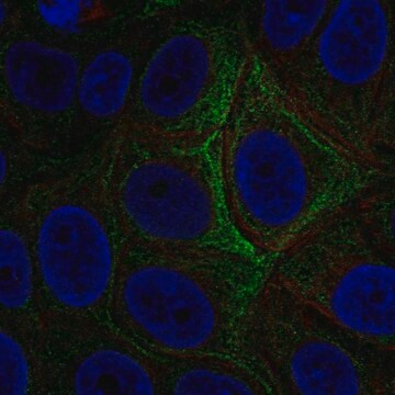 Anti-ADCY5 antibody produced in rabbit Prestige Antibodies&#174; Powered by Atlas Antibodies, affinity isolated antibody