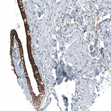 Anti-MXRA8 antibody produced in rabbit Prestige Antibodies&#174; Powered by Atlas Antibodies, affinity isolated antibody, buffered aqueous glycerol solution