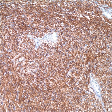 DOG1 (SP31) Rabbit Monoclonal Antibody