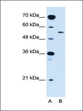 Anti-SLC2A10 antibody produced in rabbit IgG fraction of antiserum