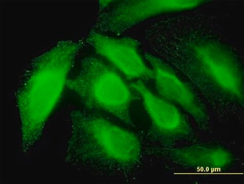 Monoclonal Anti-RNF14 antibody produced in mouse clone 4G9, purified immunoglobulin, buffered aqueous solution