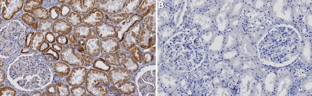 Anti-Complex I-75kD Antibody from rabbit, purified by affinity chromatography