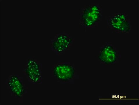 Anti-USP16 antibody produced in mouse purified immunoglobulin, buffered aqueous solution