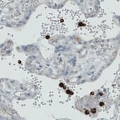Monoclonal Anti-MMP9 antibody produced in mouse Prestige Antibodies&#174; Powered by Atlas Antibodies, clone CL0539, purified immunoglobulin, buffered aqueous glycerol solution
