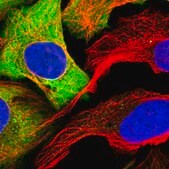 Anti-PKM antibody produced in rabbit Prestige Antibodies&#174; Powered by Atlas Antibodies, affinity isolated antibody, buffered aqueous glycerol solution
