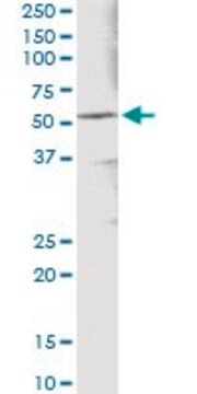 Monoclonal Anti-ALDH3A1 antibody produced in mouse clone 2G4, purified immunoglobulin, buffered aqueous solution