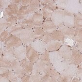Anti-PLD1 antibody produced in rabbit Prestige Antibodies&#174; Powered by Atlas Antibodies, affinity isolated antibody, buffered aqueous glycerol solution