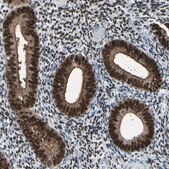 Anti-PGR antibody produced in rabbit Ab2, Prestige Antibodies&#174; Powered by Atlas Antibodies, affinity isolated antibody, buffered aqueous glycerol solution