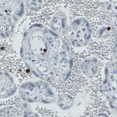 Monoclonal Anti-MMP9 antibody produced in mouse Prestige Antibodies&#174; Powered by Atlas Antibodies, clone CL0542, purified immunoglobulin, buffered aqueous glycerol solution