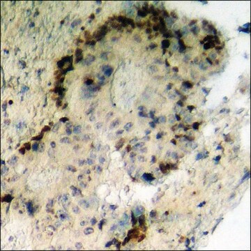 Anti-phospho-HRS (pTyr334) antibody produced in rabbit affinity isolated antibody