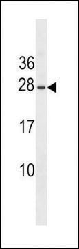 ANTI-ERYTHROPOIETIN antibody produced in rabbit affinity isolated antibody, buffered aqueous solution