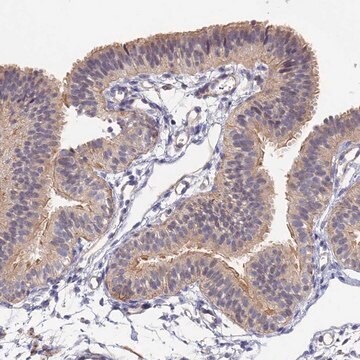 Anti-CCDC113 antibody produced in rabbit Prestige Antibodies&#174; Powered by Atlas Antibodies, affinity isolated antibody, buffered aqueous glycerol solution