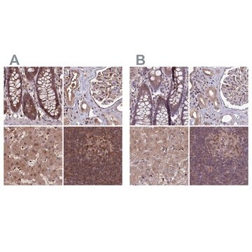 Anti-PSMB8 antibody produced in rabbit Prestige Antibodies&#174; Powered by Atlas Antibodies, affinity isolated antibody, buffered aqueous glycerol solution