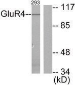 Anti-MGLUR4 antibody produced in rabbit affinity isolated antibody