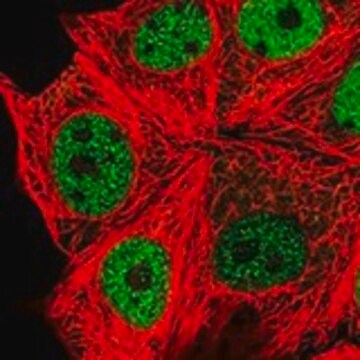 Anti-SPHK2 antibody produced in rabbit Prestige Antibodies&#174; Powered by Atlas Antibodies, affinity isolated antibody, buffered aqueous glycerol solution