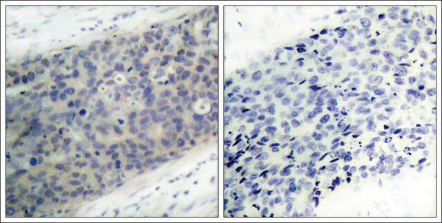 Anti-phospho-LIMK2 (pThr505) antibody produced in rabbit affinity isolated antibody