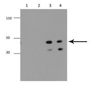 Anti-MMP13 antibody produced in rabbit affinity isolated antibody