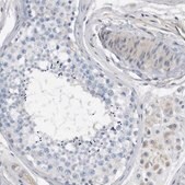 Anti-MAP2K6 antibody produced in rabbit Prestige Antibodies&#174; Powered by Atlas Antibodies, affinity isolated antibody, buffered aqueous glycerol solution