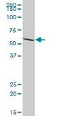 Anti-EPHX2 antibody produced in mouse IgG fraction of antiserum, buffered aqueous solution