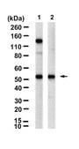 Anti-&#946;2-Adrenergic Receptor Antibody, clone 2B23 ZooMAb&#174; Rabbit Monoclonal recombinant, expressed in HEK 293 cells
