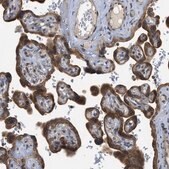 Anti-EIF2AK3 antibody produced in rabbit Prestige Antibodies&#174; Powered by Atlas Antibodies, affinity isolated antibody, buffered aqueous glycerol solution