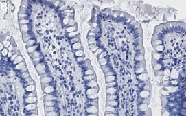 Anti-PDK1 Antibody, clone 1E13 ZooMAb&#174; Rabbit Monoclonal recombinant, expressed in HEK 293 cells