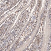 Anti-CSK antibody produced in rabbit Prestige Antibodies&#174; Powered by Atlas Antibodies, affinity isolated antibody, buffered aqueous glycerol solution