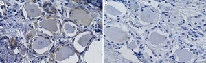 Anti-Histamine Receptor 4 Antibody, clone 1E18 ZooMAb&#174; Rabbit Monoclonal recombinant, expressed in HEK 293 cells