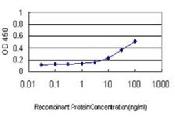 ANTI-NFKBIB antibody produced in mouse clone 1B5, purified immunoglobulin, buffered aqueous solution