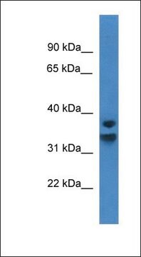 Anti-NFKBID antibody produced in rabbit affinity isolated antibody