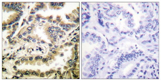 Anti-NF-&#954;B p65 (Acetyl-Lys310) antibody produced in rabbit affinity isolated antibody