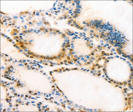 Anti-MUC16 antibody produced in rabbit affinity isolated antibody