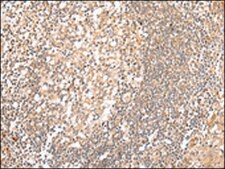 Anti-HTR2A affinity isolated antibody