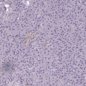 Anti-PDE2A antibody produced in rabbit Prestige Antibodies&#174; Powered by Atlas Antibodies, affinity isolated antibody, buffered aqueous glycerol solution