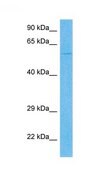 Anti-CALCRL antibody produced in rabbit affinity isolated antibody